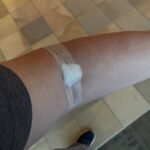 Doctor Visit